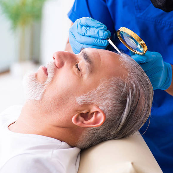 Hair Restoration Crete Liapakis 2