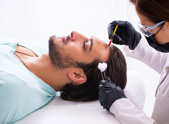 Hair Restoration Crete Liapakis 6