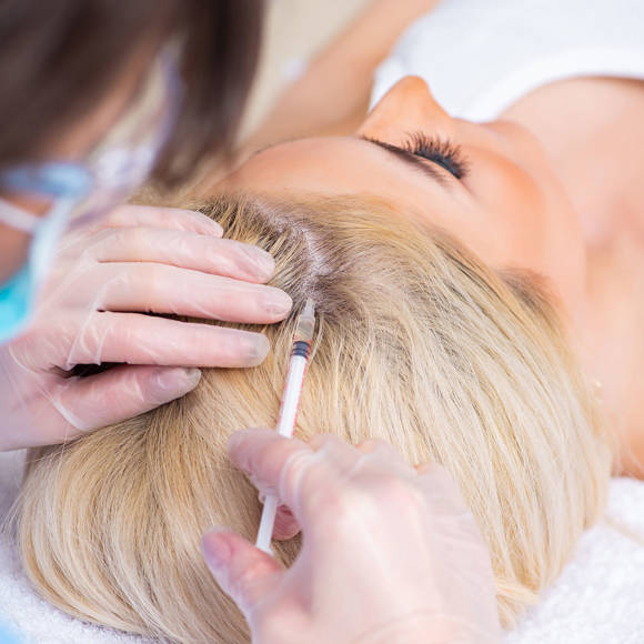 Hair Restoration Crete Liapakis 1