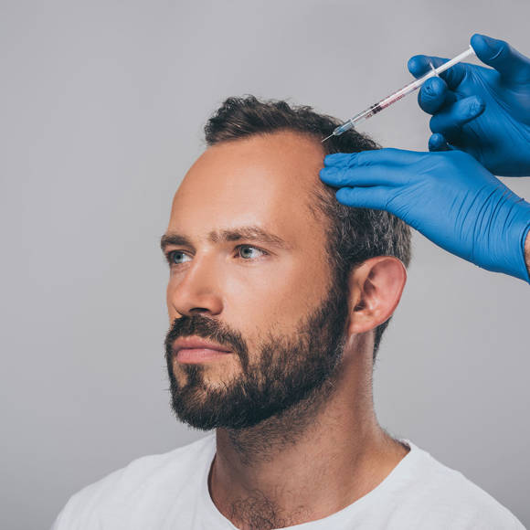 Hair Restoration Crete Liapakis 10