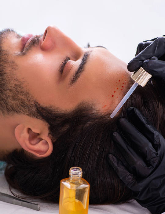 Hair Restoration Crete Liapakis 5