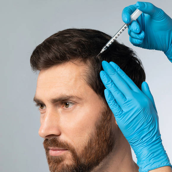 Hair Restoration Crete Liapakis 3